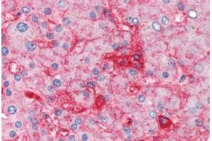 Human Liver (formalin-fixed, paraffin-embedded) stained with B2M antibody ABIN305901 at 5 ug/ml followed by biotinylated anti-mouse IgG secondary antibody ABIN481714, alkaline phosphatase-streptavidin and chromogen. (beta-2 Microglobulin 抗体)