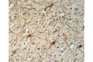 GFAP antibody immunohistochemistry analysis in formalin fixed and paraffin embedded human brain tissue. (GFAP 抗体)