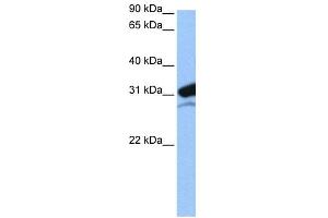 WB Suggested Anti-MRPL24 Antibody Titration:  0. (MRPL24 抗体  (N-Term))