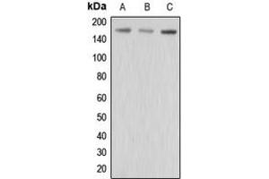 Western blot analysis of MRP3 expression in HepG2 (A), MCF7 (B), MDAMB435 (C) whole cell lysates. (ABCC3 抗体  (Center))