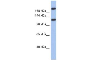 Western Blotting (WB) image for anti-Calcium Channel, Voltage Dependent, T Type, alpha 1I Subunit (CACNA1I) (Middle Region) antibody (ABIN2776236)