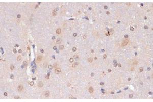 Immunohistochemistry of paraffin-embedded Rat brain using PIDD Polyclonal Antibody at dilution of 1:100 (40x lens). (PIDD 抗体)