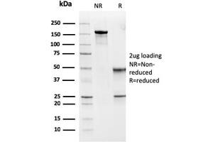 SDS-PAGE (SDS) image for anti-MutS Homolog 6 (E. Coli) (MSH6) (AA 374-540) antibody (ABIN6939576)