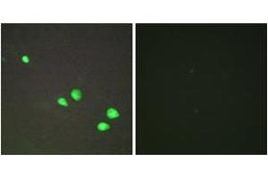 Immunofluorescence analysis of HepG2 cells, using CHD4 Antibody. (CHD4 抗体  (AA 571-620))