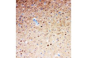 Anti-Serotonin transporter antibody, IHC(P) IHC(P): Rat Brain Tissue (SLC6A4 抗体  (N-Term))