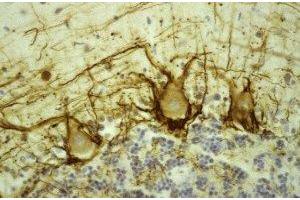 Immunostaining of human cerebellar cortex showing labeling of NF-H (brown) in basket cell axons surrounding the large Purkinje neurons. (NEFH 抗体)