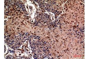 Immunohistochemistry (IHC) analysis of paraffin-embedded Human Lung, antibody was diluted at 1:100. (Ubiquitin 抗体  (Internal Region))