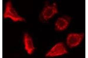ABIN6278325 staining HepG2 cells by IF/ICC. (ERAP1 抗体  (Internal Region))