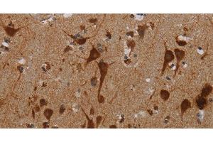 Immunohistochemistry of paraffin-embedded Human brain tissue using KMT2D Polyclonal Antibody at dilution 1:40 (Lysine (K)-Specific Methyltransferase 2B (KMT2B) 抗体)