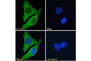 ABIN185380 Immunofluorescence analysis of paraformaldehyde fixed MCF7 cells, permeabilized with 0. (BID 抗体  (C-Term))
