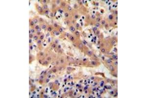 Immunohistochemistry (Paraffin-embedded Sections) (IHC (p)) image for anti-Haptoglobin (HP) (AA 299-326), (Middle Region) antibody (ABIN952678)