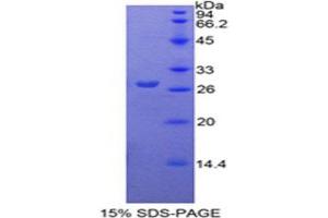SDS-PAGE (SDS) image for Pyruvate Kinase M2 (PKM2) (AA 324-531) protein (His tag) (ABIN2126602)