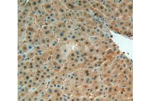 IHC-P analysis of Liver Tissue, with DAB staining. (MIF 抗体  (AA 3-111))