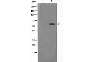 Western blot analysis of extracts of HT-29 cell line,usingPAK4antibody (PAK4 抗体  (Internal Region))