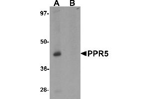 Western blot analysis of PRR5 in SK-N-SH cell lysate with PRR5 antibody at 1 µg/mL in (A) the absence and (B) the presence of blocking peptide (PRR5 抗体  (C-Term))