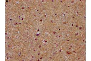 IHC image of ABIN7168374 diluted at 1:300 and staining in paraffin-embedded human brain tissue performed on a Leica BondTM system. (MEX3B 抗体  (AA 253-375))