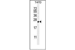 Western blot analysis of GAGE12B Antibody (N-term) in T47D cell line lysates (35ug/lane). (G Antigen 12B 抗体  (N-Term))