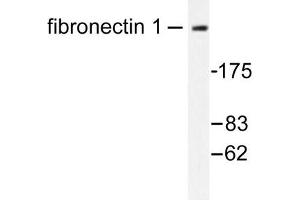 Image no. 1 for anti-Fibronectin antibody (ABIN272101) (Fibronectin 抗体)