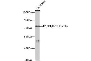 Western Blotting (WB) image for anti-Interleukin 18 Receptor 1 (IL18R1) (AA 19-320) antibody (ABIN3023691)