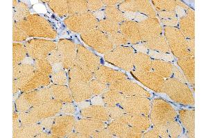 ABIN6258681 and ABIN6274241 at 1/100 staining Rat skin tissue by IHC-P. (ACTN2/3 抗体  (N-Term))