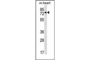 Western blot analysis of PARP2 Antibody (C-term) in mouse heart tissue lysates (35ug/lane).