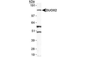 Western blot analysis of DUOX2 in A-549 in cell lysate using DUOX2 polyclonal antibody . (DUOX2 抗体  (AA 400-500))