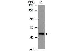 WB Image Sample(30 ug whole cell lysate) A:Hep G2, 7. (ALDH6A1 抗体)