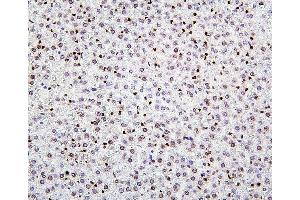 IHC analysis of H1F0 using anti-H1F0 antibody (ABIN7600521).