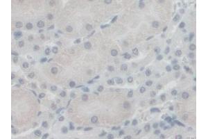 Immunohistochemistry (IHC) image for anti-G-Elongation Factor, Mitochondrial 1 (GFM1) (AA 511-751) antibody (ABIN7444172)