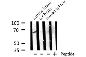 Western blot analysis of  RPA1 expression in various lysates (RPA1 抗体  (Internal Region))