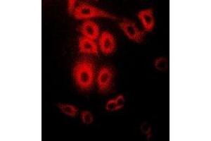 Immunofluorescent analysis of Telethonin staining in Hela cells. (TCAP 抗体)
