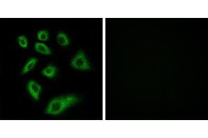 Peptide - +Immunohistochemistry analysis of paraffin-embedded human liver carcinoma tissue using Cytochrome P450 2W1 antibody.