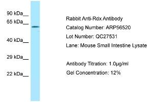Western Blotting (WB) image for anti-Radixin (RDX) (C-Term) antibody (ABIN2786751) (Radixin 抗体  (C-Term))