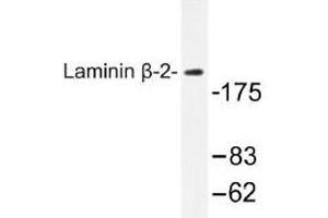 Image no. 1 for anti-Laminin, beta 2 (Laminin S) (LAMB2) antibody (ABIN317724) (LAMB2 抗体)