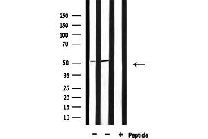 anti-6-phosphofructo-2-Kinase/fructose-2,6-Biphosphatase 1/4 (PFKFB1/4) (Internal Region) antibody