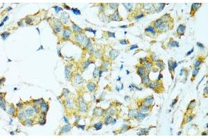 Immunohistochemistry (Paraffin-embedded Sections) (IHC (p)) image for anti-Cytochrome P450, Family 2, Subfamily B, Polypeptide 6 (CYP2B6) antibody (ABIN7258000)