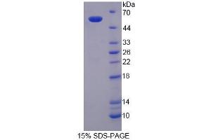SDS-PAGE analysis of Mouse SPTLC3 Protein. (SPTLC3 蛋白)