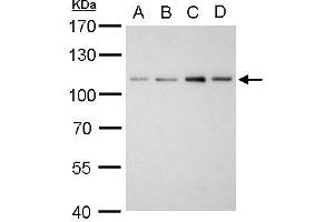 WB Image Alpha Actinin 2 antibody [N1N3] detects ACTN2 protein by western blot analysis. (ACTN2 抗体)