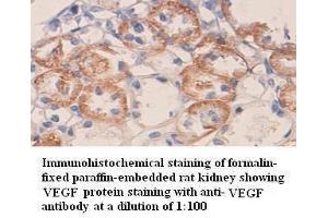 Immunohistochemistry (IHC) image for anti-Vascular Endothelial Growth Factor A (VEGFA) antibody (ABIN6583751) (VEGFA 抗体)