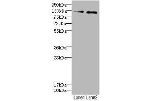 Western blot All lanes: HEPH antibody at 2. (Hephaestin 抗体  (AA 300-580))
