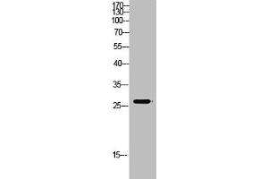 Western Blot analysis of mouse-kidney cells using Antibody diluted at 500. (MBL2 抗体  (AA 21-70))