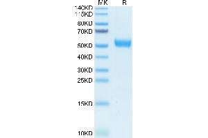SDS-PAGE (SDS) image for Interleukin 5 Receptor, alpha (IL5RA) (AA 21-335) protein (His-Avi Tag) (ABIN7275034)