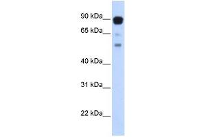 WB Suggested Anti-ZNF408 Antibody Titration:  0. (ZNF408 抗体  (Middle Region))