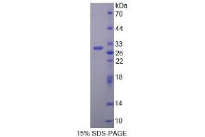 SDS-PAGE analysis of Rat BCAT1 Protein. (BCAT1 蛋白)