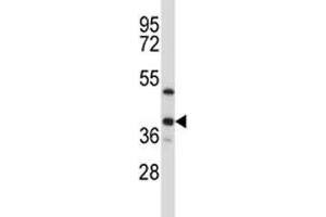 ERCC1 antibody western blot analysis in T47D lysate (ERCC1 抗体  (AA 268-297))