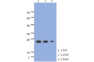 The cell lysates of HepG2 (40ug) were resolved by SDS-PAGE, transferred to PVDF membrane and probed with anti-human ADI1 antibody (1:500 ~ 1:1000). (ADI1 抗体)