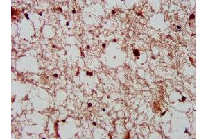 IHC image of ABIN7148847 diluted at 1:600 and staining in paraffin-embedded human brain tissue performed on a Leica BondTM system. (Cyclin-Dependent Kinase 11A (CDK11A) (AA 5-216) 抗体)