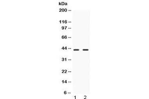 Western blot testing of 1) rat liver and 2) human HeLa lysate with NR2F6 antibody at 0. (NR2F6 抗体)