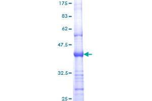 Image no. 1 for Receptor tyrosine-protein kinase erbB-2 (ErbB2/Her2) (AA 22-121) protein (GST tag) (ABIN1353013)
