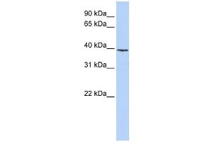 H2AFY antibody used at 1 ug/ml to detect target protein. (H2AFY 抗体  (N-Term))